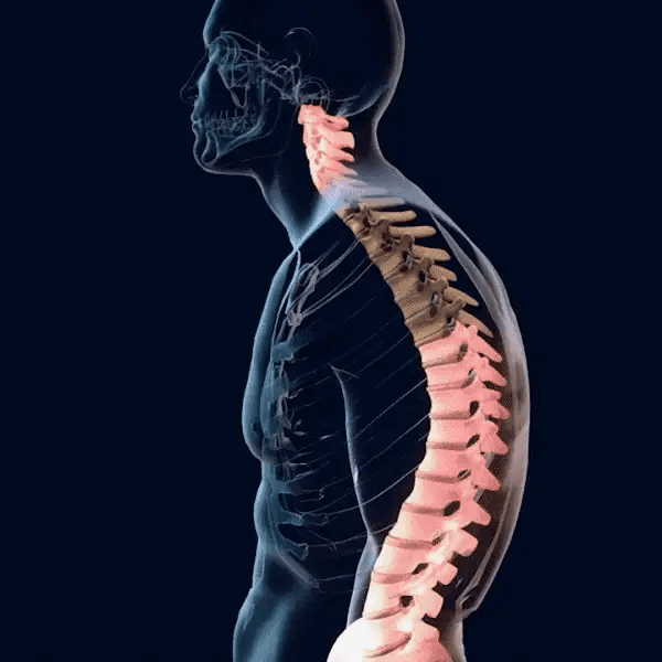 ErgoAlign - Correcto Postural